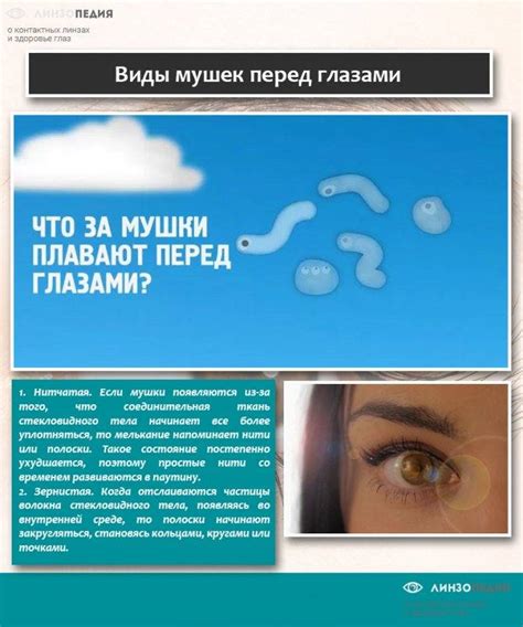Когда смотришь на белое видишь черные точки. перед глазами летают ...