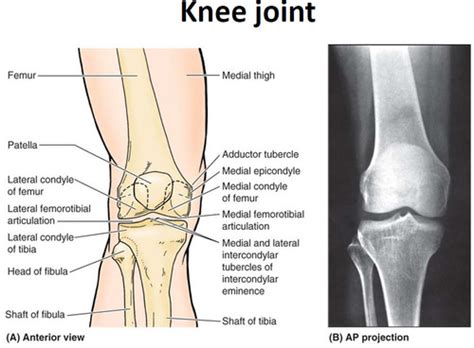 Dmtp Training Monographs Knee Flashcards Quizlet