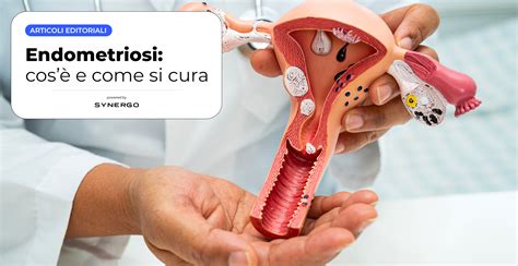 Endometriosi Cos E Come Si Cura Casa Di Cura Pierangeli Casa Di