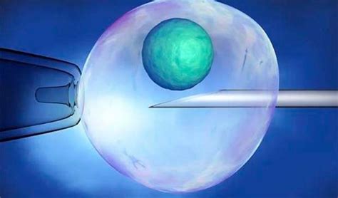 Unlocking New Frontiers In Ivf Laser Assisted Hatching Lah