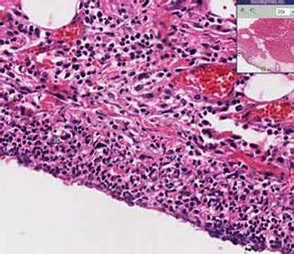 Pericardium Histology