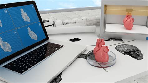 3d Printing In Healthcare Alexander Pinker