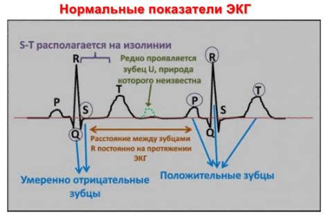Как расшифровать кардиограмму сердца - примеры, картинки