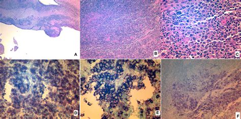 Histopathologic Analysis Of The Resected Specimen A Hematoxylin And