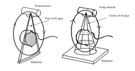 Cone Beam Tomografia Computarizada De Haz Conico Aplicaciones En