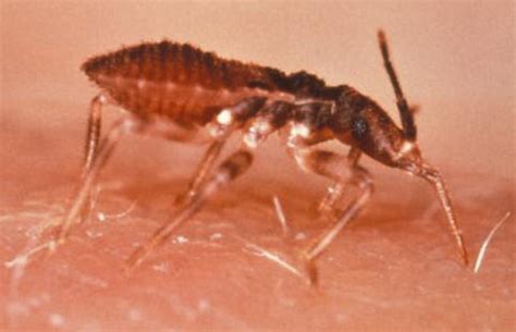 Harrison Buzz: kissing bug bite symptoms