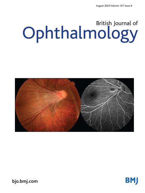 Journals Healthcare Science Ophthalmology Libguides At University Of Gloucestershire