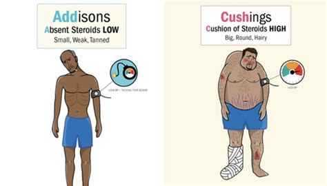 Addison S Disease Cushing S Syndrome Flashcards Quizlet