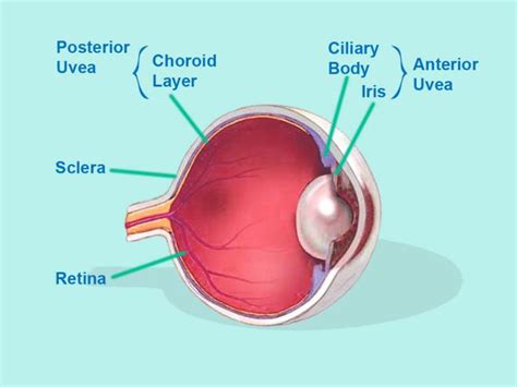 Anterior Uveitis Pearls And Pitfalls County Em