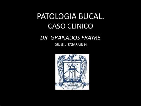 Patologia bucal | PPT