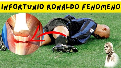 L infortunio di Ronaldo il Fenomeno che cambiò la storia del calcio