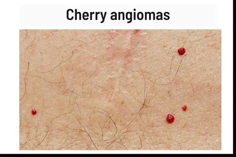 Red Spots On Skin 38 Causes Pictures And Treatment