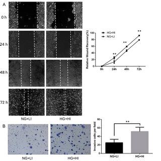 Effect Of High Glucose And High Insulin On McF 7 Cell Migration And