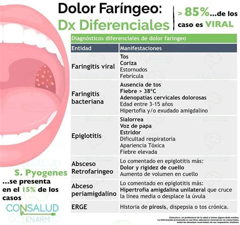 CONSALUD ENARM En Instagram Hablemos De FARINGITIS Y DX DIFERENCIALES