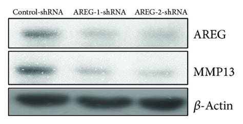 Concentration And Time Dependent Increases In Mmp Production By