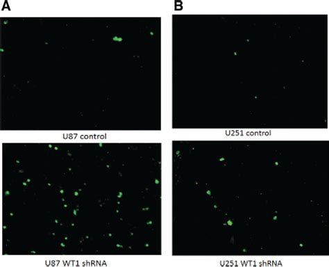 Figure 3 WT1 Regulates Apoptosis In Glioblastoma Wilms Tumor