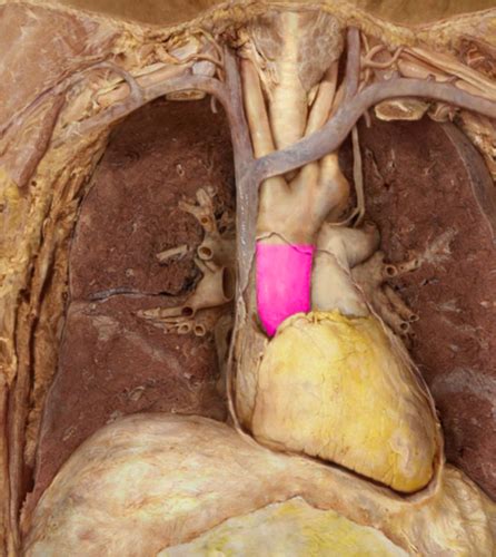 Intro To Blood Vessels And Arteries Of The Upper Body Lab Guide