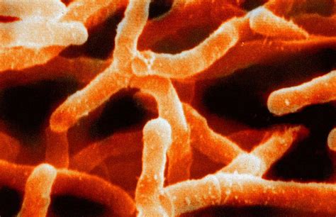 Actinomyces - wikidoc