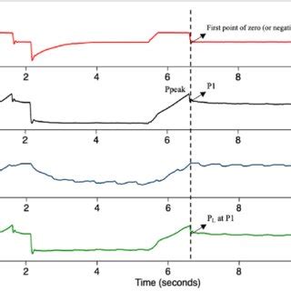 Method For P1 Calculation Flow Time Trace Red And Airway Paw