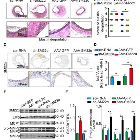 Sm22α Smooth Muscle 22α Deficiency Promotes Aa Formation In Ang Ii