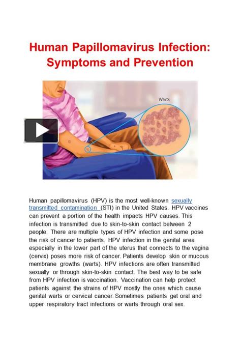 Ppt Human Papillomavirus Infection Hpv Symptoms And Prevention Powerpoint Presentation