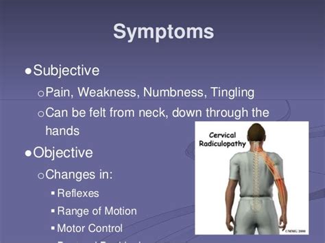 Cervical Radiculopathy Power Pointppt