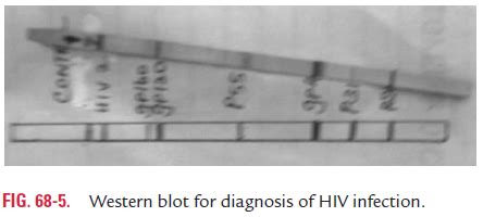 Laboratory Diagnosis HIV Virus Infection