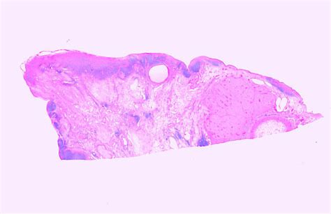 Hls Female Reproductive System Ovary Corpus Luteum Low Mag