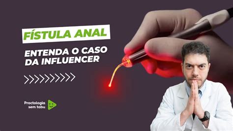 O Que F Stula Anal Entenda O Caso Da Influencer Que Teve Que Operar