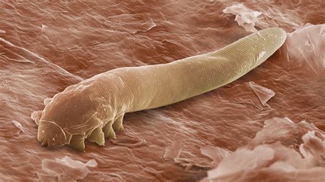 25 Best Demodex Causes Demodectic Mange