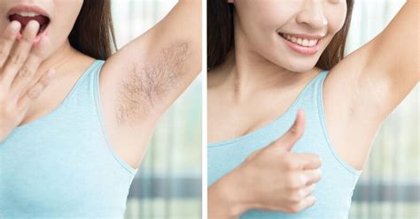 In Just 5 Minutes Remove Armpit Hair Permanently Remove Armpit Hair