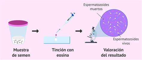 Tinción de espermatozoides para el test de vitalidad