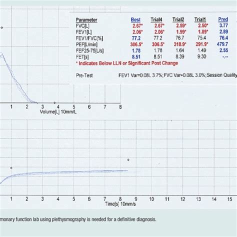 Normal Spirometry Results | Download Scientific Diagram