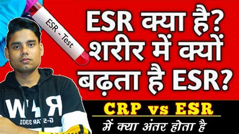 Esr Test Kya Hai Esr Blood Test Kya Hai In Hindi Crp Vs Esr