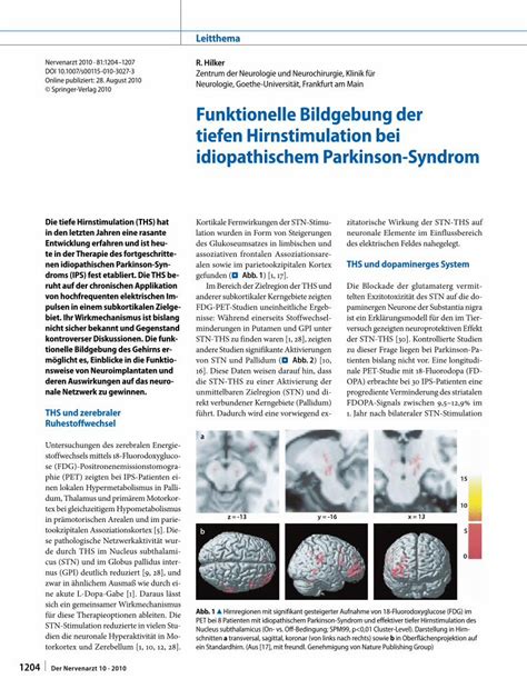 Pdf Funktionelle Bildgebung Der Tiefen Hirnstimulation Bei