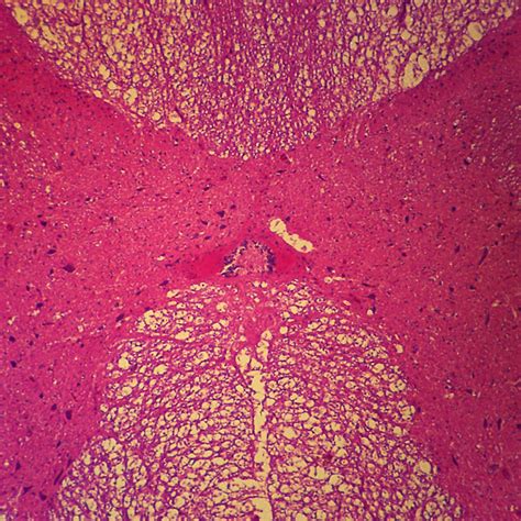 Spinal Cord Tissue Slide