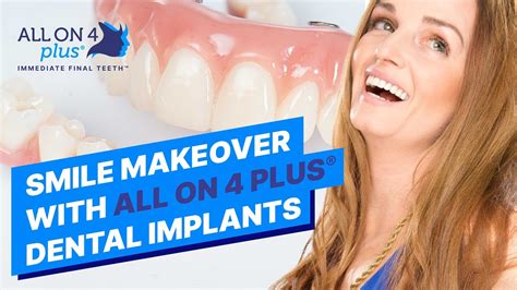 Smile Makeover With All On Dental Implants Youtube