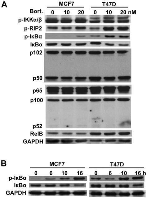 IKKβ inhibitor in combination with bortezomib induces cytotoxicity in