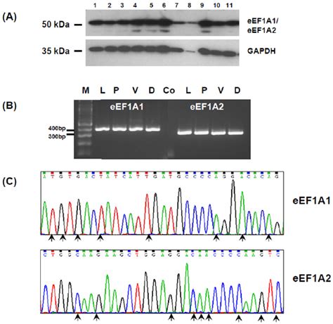 The Expression Of Eef A And Eef A Isoforms In Human Prostate Cancer