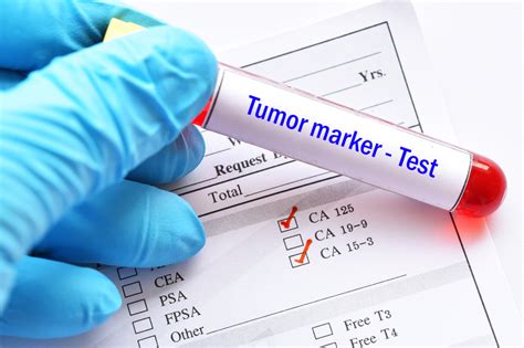 Tumor Markeri Ne Pokazuju Samo Vrednosti Koje Ukazuju Na Maligne