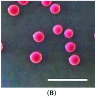 Candida Glabrata Cells A Microscopy Structure B On Chromagar Tm