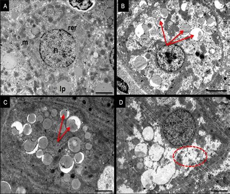 Transmission Electron Microscopy Images A Control Liver Nucleus