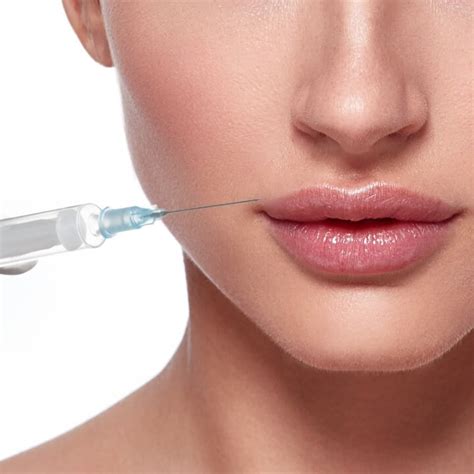 Dermal Fillers Injections In Boston Ma And Providence Ri Skinsational