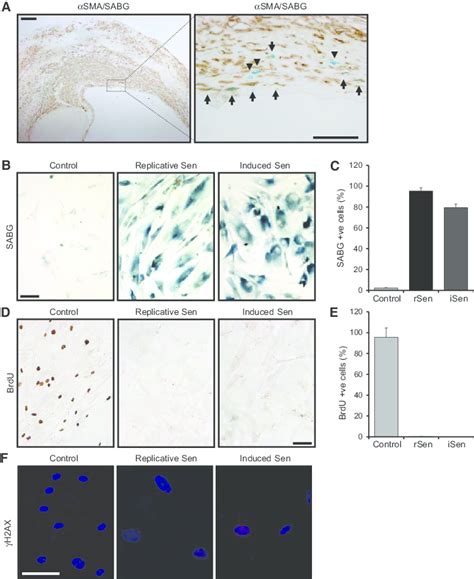 Vascular Smooth Muscle Cell VSMC Senescence Which Occurs In Mature