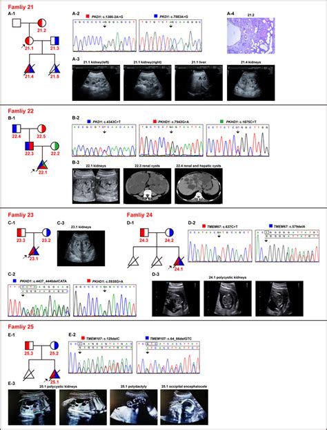 Pedigree Diagrams Clinical Findings And Genetic Variants For Families