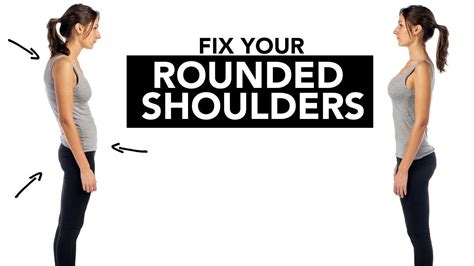 Fix Your ROUNDED SHOULDERS Better Posture In 4 EASY STEPS YouTube