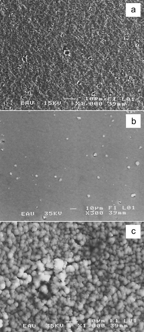 Corrosion Behaviour Of Ti Dlc Deposition On Prenitrided 316l Stainless