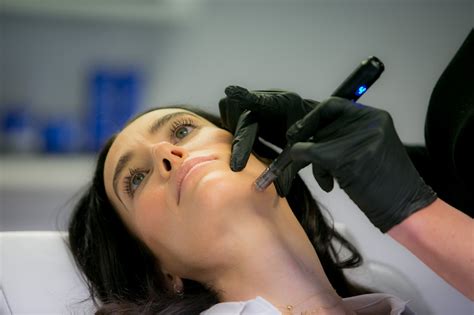 Microneedling In Lichfield Staffordshire Botox Dermal Fillers Skin