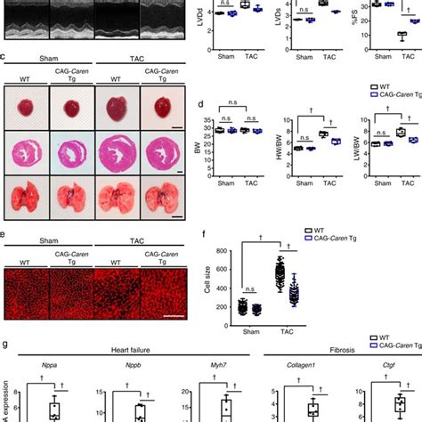 Intravenous Injection Of Aav Caren Slows The Progression Of Heart