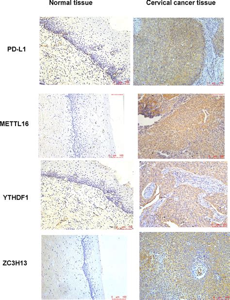 Frontiers Comprehensive Characterization Of Tumor Microenvironment